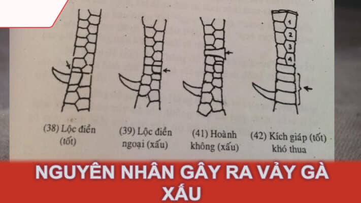 Nguyên nhân gây ra vảy gà xấu